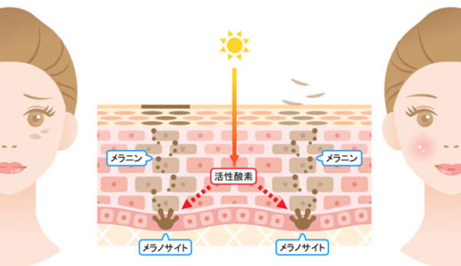 紫外線だけではない！活性酸素が増えすぎるとシミの原因に・・・